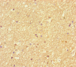 Septin 2 Polyclonal Antibody