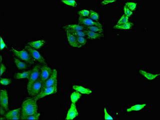 MADCAM1 Polyclonal Antibody