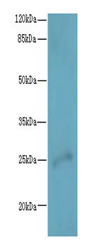 RAB32 Polyclonal Antibody