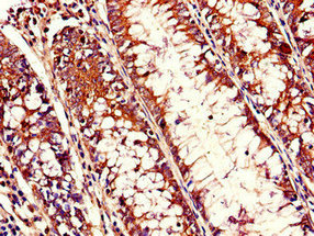 RHOH Polyclonal Antibody