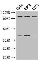 PSMD2 Polyclonal Antibody