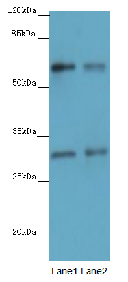 SMAD4 Polyclonal Antibody