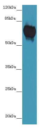 KRT72 Polyclonal Antibody