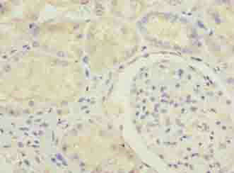 MED22 Polyclonal Antibody