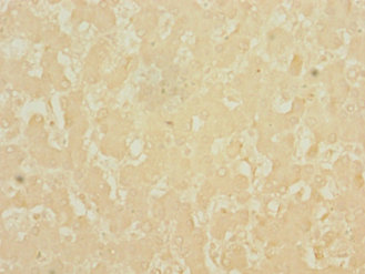 DNASE1L3 Polyclonal Antibody