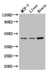 KCNJ11 Polyclonal Antibody