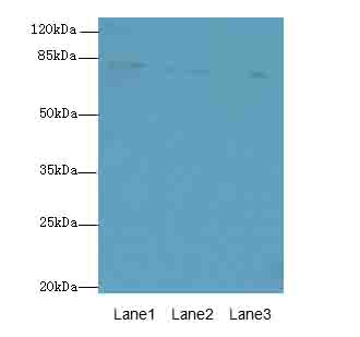 ACAP1 Polyclonal Antibody