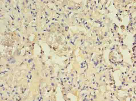 Immunohistochemistry of paraffin-embedded human lung tissue using ACAP1 Polyclonal Antibody at dilution of 1:100