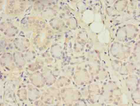 Immunohistochemistry of paraffin-embedded human pancreatic tissue using ACAP1 Polyclonal Antibody at dilution of 1:100