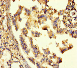 GABRA6 Polyclonal Antibody