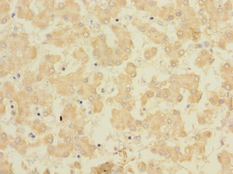 FAM187B Polyclonal Antibody
