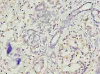 TRAM2 Polyclonal Antibody