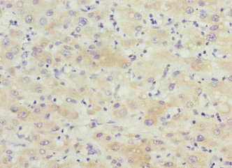 KCTD19 Polyclonal Antibody