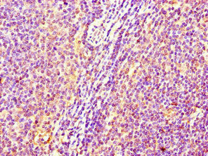 C17orf58 Polyclonal Antibody