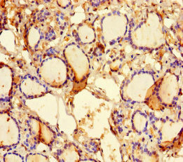 KLHL38 Polyclonal Antibody