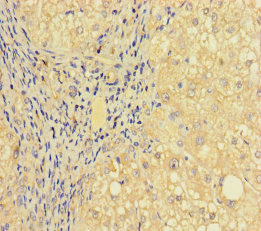 PRICKLE4 Polyclonal Antibody