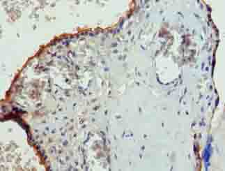Immunohistochemistry of paraffin-embedded human placenta tissue using PGS1 Polyclonal Antibody at dilution of 1:100