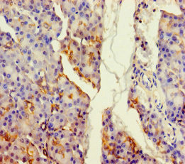 ALDH1L2 Polyclonal Antibody