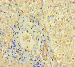 KRT71 Polyclonal Antibody