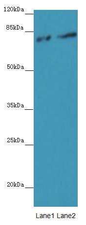 FAM161A Polyclonal Antibody