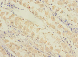 GRAMD1B Polyclonal Antibody