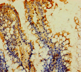 MOGAT2 Polyclonal Antibody