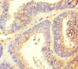 TTLL9 Polyclonal Antibody
