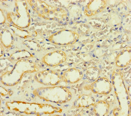 SLC25A35 Polyclonal Antibody