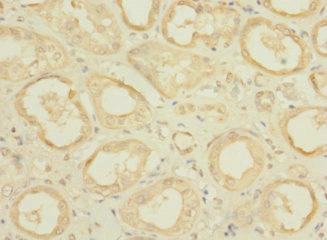 CFAP100 Polyclonal Antibody