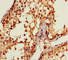 ANKDD1A Polyclonal Antibody