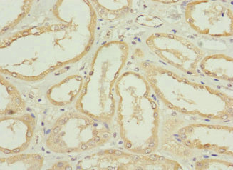 NRN1L Polyclonal Antibody