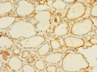 C8orf34 Polyclonal Antibody