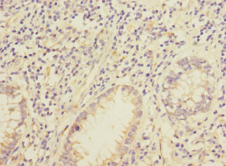 IQCC Polyclonal Antibody