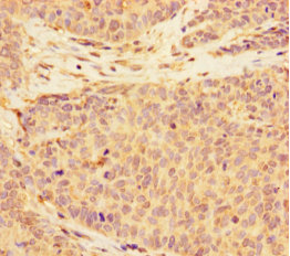 ALS2CR11 Polyclonal Antibody