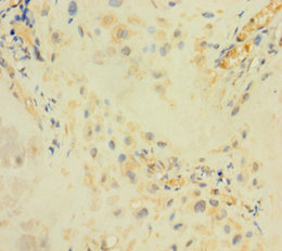 ARSI Polyclonal Antibody (20 µl)