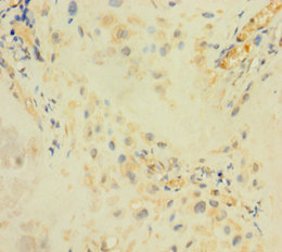 ARSI Polyclonal Antibody