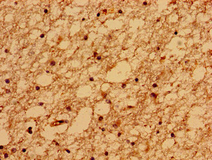TMEM67 Polyclonal Antibody
