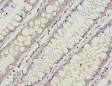 GCSAML Polyclonal Antibody