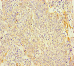 PAGE2B Polyclonal Antibody