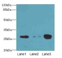 KHDC1 Polyclonal Antibody