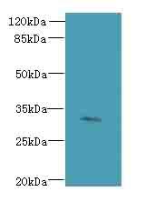 FAM78A Polyclonal Antibody