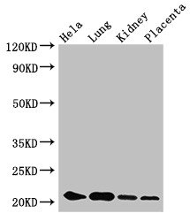 KRBOX4 Polyclonal Antibody