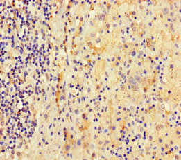 ATAD3C Polyclonal Antibody