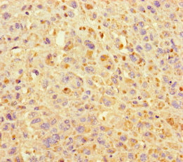 KIF24 Polyclonal Antibody