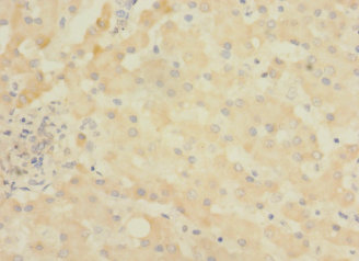 ASPHD1 Polyclonal Antibody (50 µl)