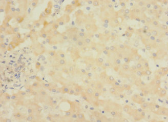 ASPHD1 Polyclonal Antibody