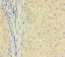 TXNDC8 Polyclonal Antibody