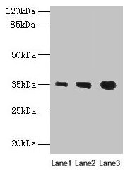 PVRIG Polyclonal Antibody