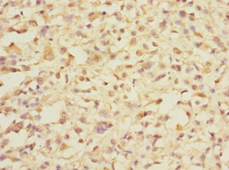DDX59 Polyclonal Antibody