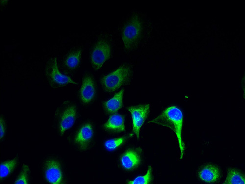 ZDHHC20 Polyclonal Antibody